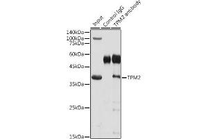 Immunoprecipitation analysis of 300 μg extracts of Mouse skeletal muscle cells using 3 μg TPM2 antibody (ABIN3017364, ABIN3017365, ABIN3017366 and ABIN6220054).