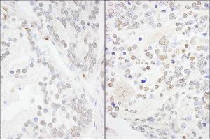 anti-Ankyrin Repeat and SAM Domain-Containing Protein 3 (ANKS3) (AA 606-656) antibody