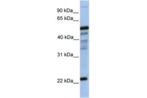 Western Blotting (WB) image for anti-Prostaglandin D2 Synthase (PTGDS) antibody (ABIN2463214) (PTGDS anticorps)