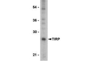 Western blot analysis of TIRP in PC-3 cell lysate with this product at 1 μg/ml. (TICAM2 anticorps  (C-Term))