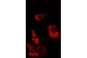 anti-Actinin, alpha 1 (ACTN1) (N-Term) antibody