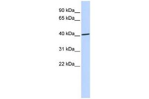 Human 721_B; WB Suggested Anti-ZNF696 Antibody Titration: 0. (ZNF696 anticorps  (N-Term))