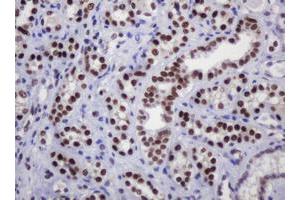 Image no. 4 for anti-Decapping Enzyme, Scavenger (DCPS) antibody (ABIN1497781)