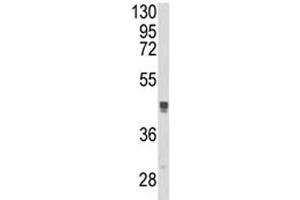 Western blot analysis of TGN46 antibody and MCF-7 lysate. (TGOLN2 anticorps  (AA 399-427))