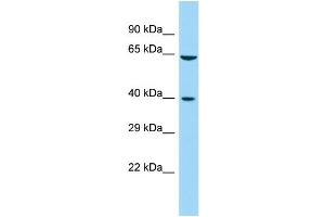 Host: Rabbit Target Name: FAM172A Sample Type: Fetal Kidney lysates Antibody Dilution: 1. (Fam172a anticorps  (Middle Region))