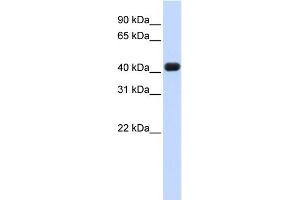 WB Suggested Anti-RTCD1 Antibody Titration: 0. (RTCD1 anticorps  (N-Term))