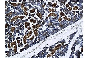 Formalin-fixed and paraffin embedded rat submandibular gland labeled with Anti-GnRHR Polyclonal Antibody, Unconjugated followed by conjugation to the secondary antibody and DAB staining (GNRHR anticorps  (AA 201-328))
