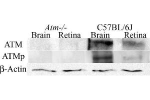 Determination of ATM and ATMp antibodies specificity by western blotting. (ATM anticorps  (AA 1974-1988))