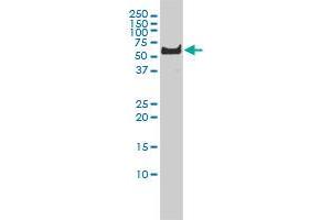 PLK1 monoclonal antibody (M01), clone 2G12 Western Blot analysis of PLK1 expression in Hela S3 NE .