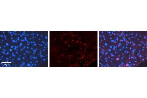 Rabbit Anti-CEBPD Antibody   Formalin Fixed Paraffin Embedded Tissue: Human Liver Tissue Observed Staining: Nucleus Primary Antibody Concentration: 1:100 Other Working Concentrations: N/A Secondary Antibody: Donkey anti-Rabbit-Cy3 Secondary Antibody Concentration: 1:200 Magnification: 20X Exposure Time: 0. (CEBPD anticorps  (Middle Region))
