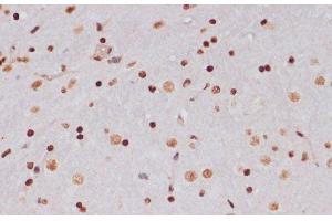 Immunohistochemistry of paraffin-embedded Mouse brain using Acetyl-Histone H3-K9/K14/K18/K23/K27 Polyclonal Antibody at dilution of 1:100 (40x lens).