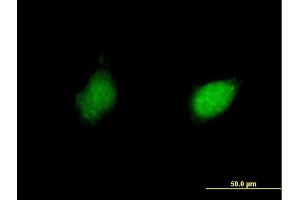 Immunofluorescence of purified MaxPab antibody to RXRG on HeLa cell. (Retinoid X Receptor gamma anticorps  (AA 1-463))