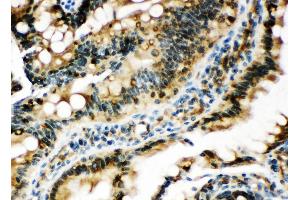 Anti-Egr1 antibody, IHC(P) IHC(P): Rat Intestine Tissue (EGR1 anticorps  (N-Term))