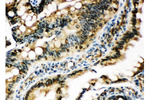 Anti-Egr1 antibody, IHC(P) IHC(P): Rat Intestine Tissue