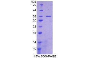 SDS-PAGE (SDS) image for Breast Cancer 1 (BRCA1) (AA 1524-1781) protein (His tag) (ABIN1980932)