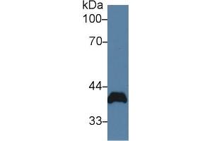 Western blot analysis of Rat Heart lysate, using Rat PVR Antibody (2 µg/ml) and HRP-conjugated Goat Anti-Rabbit antibody ( (Poliovirus Receptor anticorps  (AA 22-255))