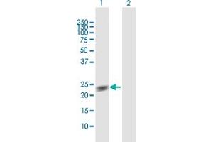 Western Blot analysis of GUK1 expression in transfected 293T cell line by GUK1 MaxPab polyclonal antibody. (GUK1 anticorps  (AA 1-197))