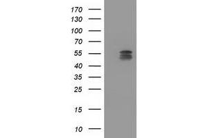 Western Blotting (WB) image for anti-Cytochrome P450, Family 2, Subfamily C, Polypeptide 9 (CYP2C9) antibody (ABIN1497726) (CYP2C9 anticorps)