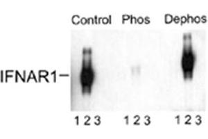Western blot of immunoprecipitates from HEK 293 cells transfected with 1. (IFNAR1 anticorps  (pSer535, pSer539))
