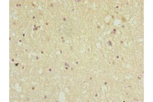 Immunohistochemistry of paraffin-embedded human brain tissue using ABIN7169258 at dilution of 1:100 (PPP2R5C anticorps  (Regulatory Subunit Gamma))
