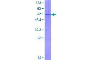 Image no. 1 for Carbonic Anhydrase VA (CA5A) (AA 1-305) protein (GST tag) (ABIN1347775)