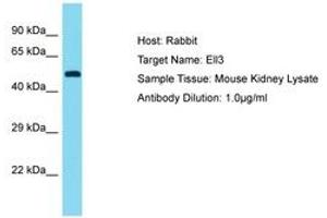 Image no. 1 for anti-Elongation Factor RNA Polymerase II-Like 3 (ELL3) (C-Term) antibody (ABIN6750477) (ELL3 anticorps  (C-Term))