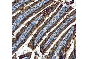 IHC analysis of ALDH1B1 using anti-ALDH1B1 antibody (ABIN4886450).