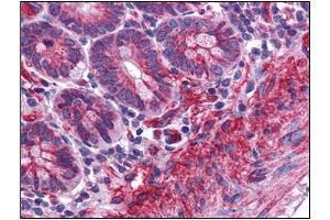Human Small Intestine: Formalin-Fixed, Paraffin-Embedded (FFPE) (MTCH2 anticorps  (N-Term))
