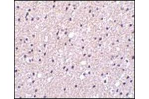Immunohistochemistry of Presenilin1 in human brain tissue with this product at 2.