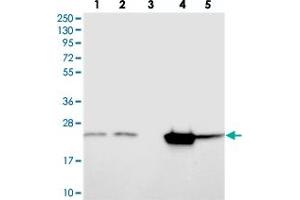 Western blot analysis of Lane 1: RT-4, Lane 2: U-251 MG, Lane 3: Human Plasma, Lane 4: Liver, Lane 5: Tonsil with KCNG1 polyclonal antibody  at 1:250-1:500 dilution.