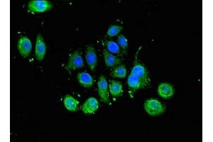Immunofluorescent analysis of A549 cells using ABIN7164181 at dilution of 1:100 and Alexa Fluor 488-congugated AffiniPure Goat Anti-Rabbit IgG(H+L)