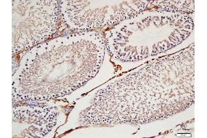 Formalin-fixed and paraffin embedded  labeled with Rabbit Anti-Cyclin H Polyclonal Antibody, Unconjugated (ABIN734408) at 1:200 followed by conjugation to the secondary antibody and DAB staining
