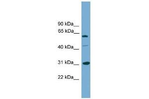 RAD1 antibody used at 0. (RAD1 anticorps  (Middle Region))