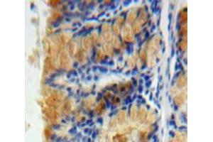 Used in DAB staining on fromalin fixed paraffin-embedded Bowels tissue (Caspase 6 anticorps  (AA 194-293))