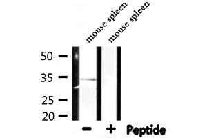 Western blot analysis of extracts from mouse spleen, using RPL5 Antibody. (RPL5 anticorps  (C-Term))