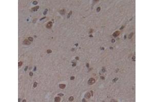 Used in DAB staining on fromalin fixed paraffin- embedded Kidney tissue (Deltex Homolog 1 anticorps  (AA 290-535))