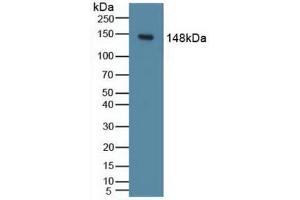 Western blot analysis of Mouse Liver Tissue. (PIK3CD anticorps  (AA 774-1044))