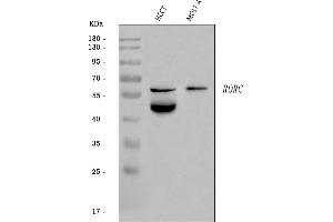 Western blot analysis of ROR gamma/RORC using anti-ROR gamma/RORC antibody (ABIN7601098).