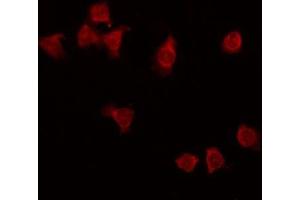 ABIN6275297 staining HT29 by IF/ICC. (NXPH3 anticorps  (Internal Region))