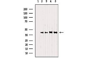 Western blot analysis of extracts from various samples, using NSDHL Antibody. (NSDHL anticorps  (Internal Region))
