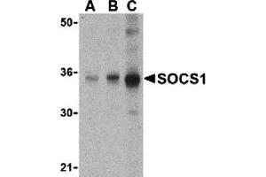 Western Blotting (WB) image for anti-Suppressor of Cytokine Signaling 1 (SOCS1) (N-Term) antibody (ABIN1031580) (SOCS1 anticorps  (N-Term))