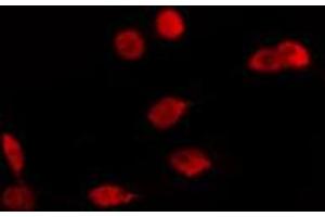 ABIN6274113 staining Hela cells by IF/ICC. (LMX1B anticorps  (Internal Region))