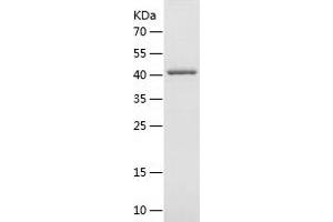 Western Blotting (WB) image for V-Akt Murine Thymoma Viral Oncogene Homolog 1 (AKT1) (AA 1-149) protein (GST tag) (ABIN7125673)