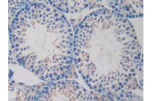 IHC-P analysis of Mouse Testis Tissue, with DAB staining. (OLR1 anticorps  (AA 60-312))