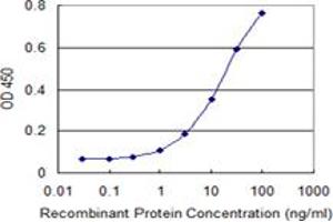 Detection limit for recombinant GST tagged ALDH18A1 is 0.