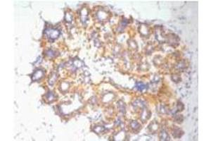 Immunohistochemistry (IHC) staining of Human Ovary tissue, diluted at 1:200. (beta Actin anticorps)