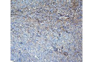 IHC analysis of LOR using anti-LOR antibody (ABIN6719582). (LOR anticorps  (AA 1-312))