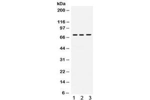 Western blot testing of human 1) 22RV1, 2) SW579 and 3) A549 cell lysate with Myelin-associated glycoprotein antibody.