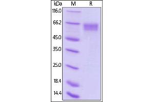 Biotinylated Human LILRA6, His,Avitag on  under reducing (R) condition.