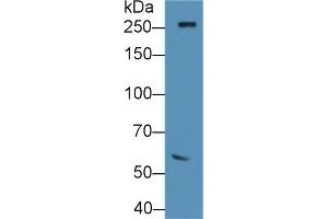 Detection of FN in Rat Serum using Polyclonal Antibody to Fibronectin (FN) (Fibronectin anticorps  (AA 355-558))